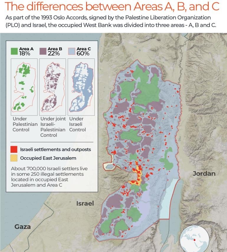 the differences between areas a-b-and-c